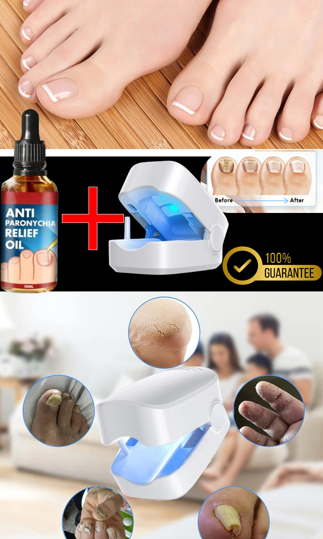 Pro Pack Renovador Anti Hongos